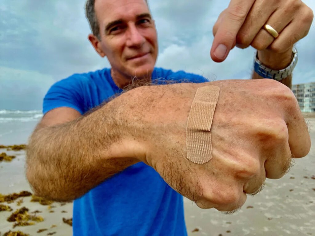Deadly ‘flesh-eating bacteria’ can thrive at the beach. How to stay safe.
