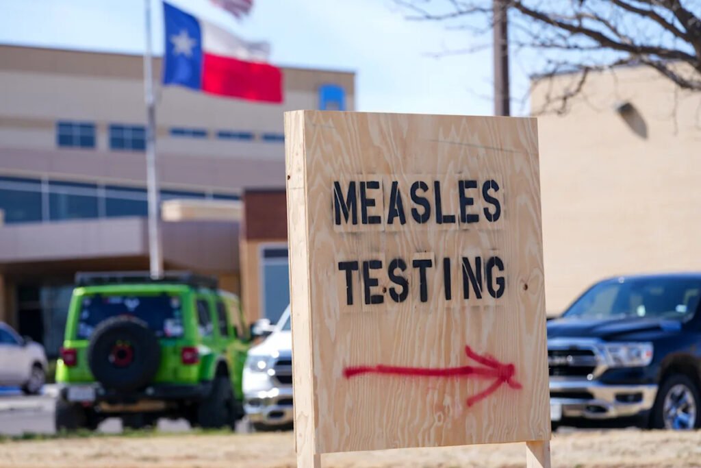 The US is having its worst year for measles in more than three decades