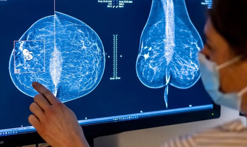 New 1-day surgery removes cancer and reconstructs the breast in the same operation