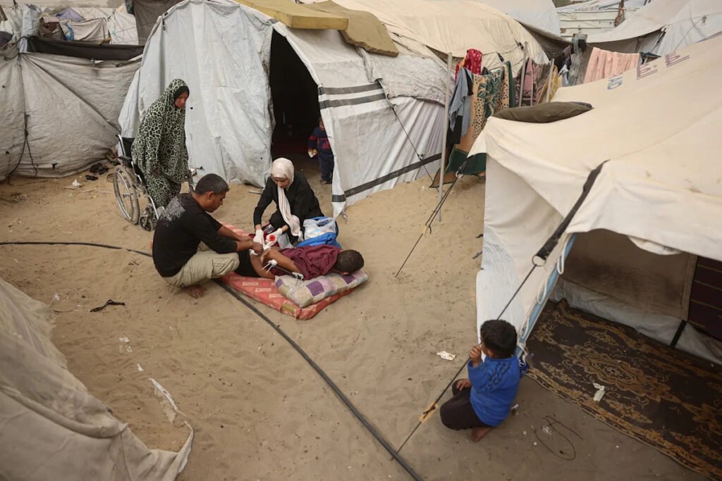 Up to 46,000 injuries in Gaza require reconstructive surgery, study finds